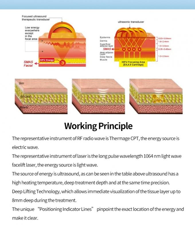 고강도 집중 초음파 비수술 얼굴 및 신체 치료 3D 히푸 기계 피부 리프팅 및 표적 지방 감소 1