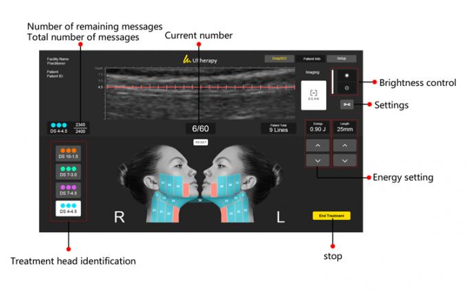 고강도 집중 초음파 비수술 얼굴 및 신체 치료 3D 히푸 기계 피부 리프팅 및 표적 지방 감소 8