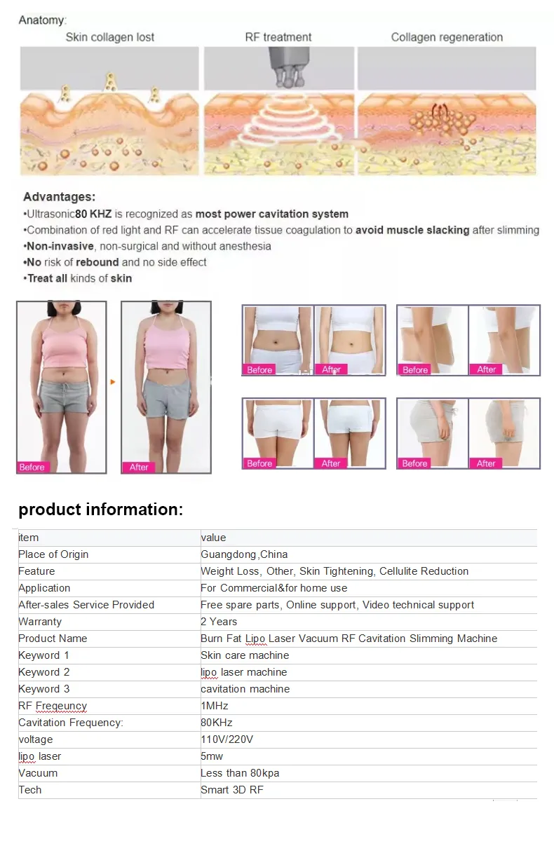 6 In 1 Body Slimming Machine RF Ultrasonic Cavitation Machine 40k 8