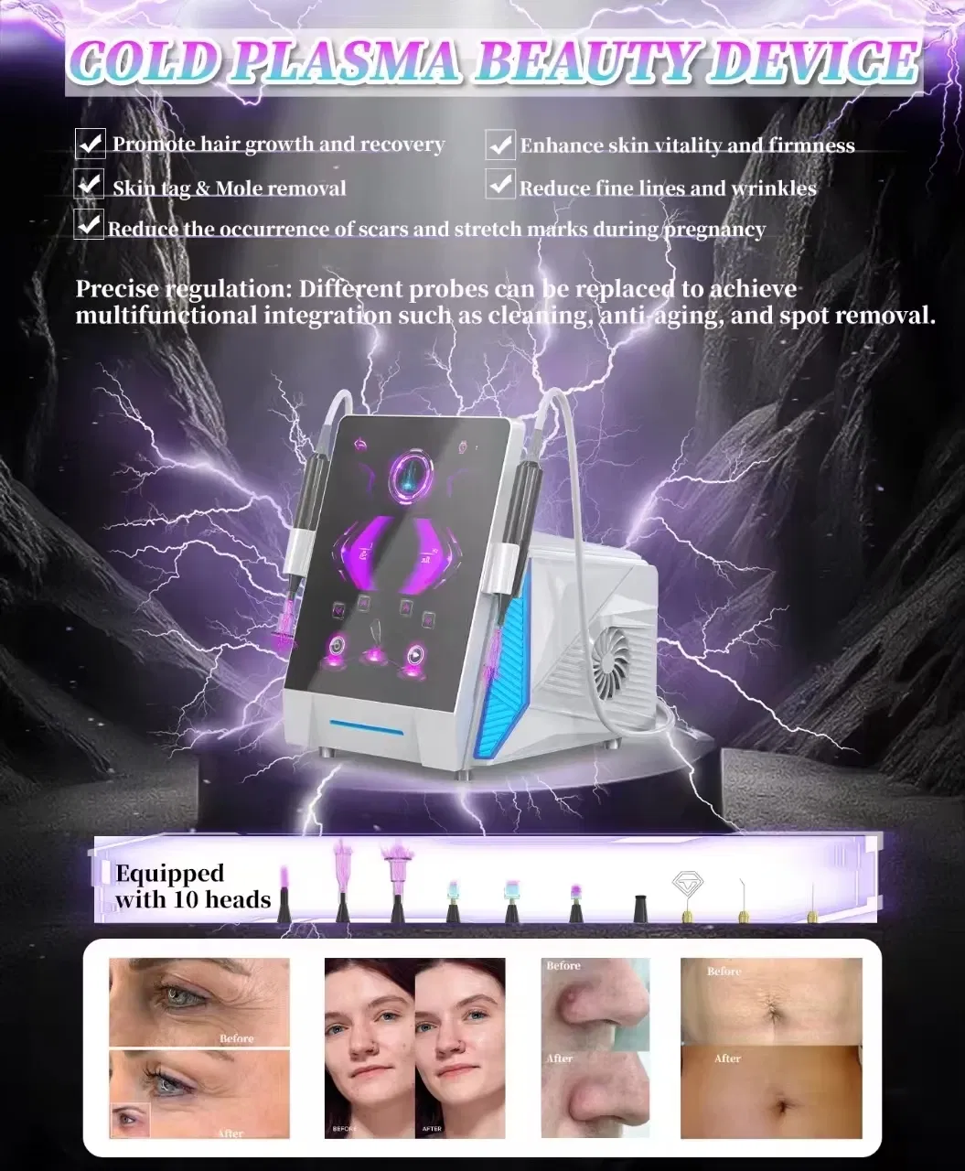 Professional Cold Plasma Skin Rejuvenation Machine for Face and Body 0