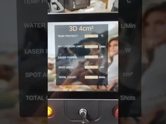 3000w laser handle of diode laser hair removal   machine